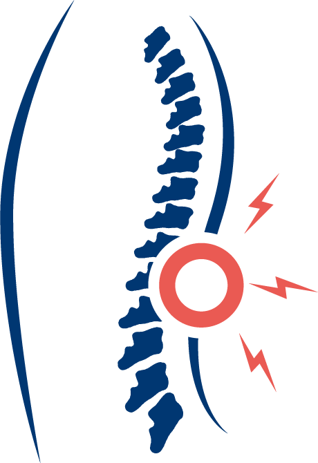 What causes back pain?